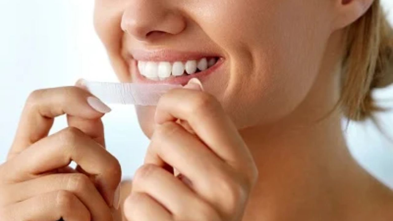 All Information to Know About Professional Teeth Whitening Dry Strips